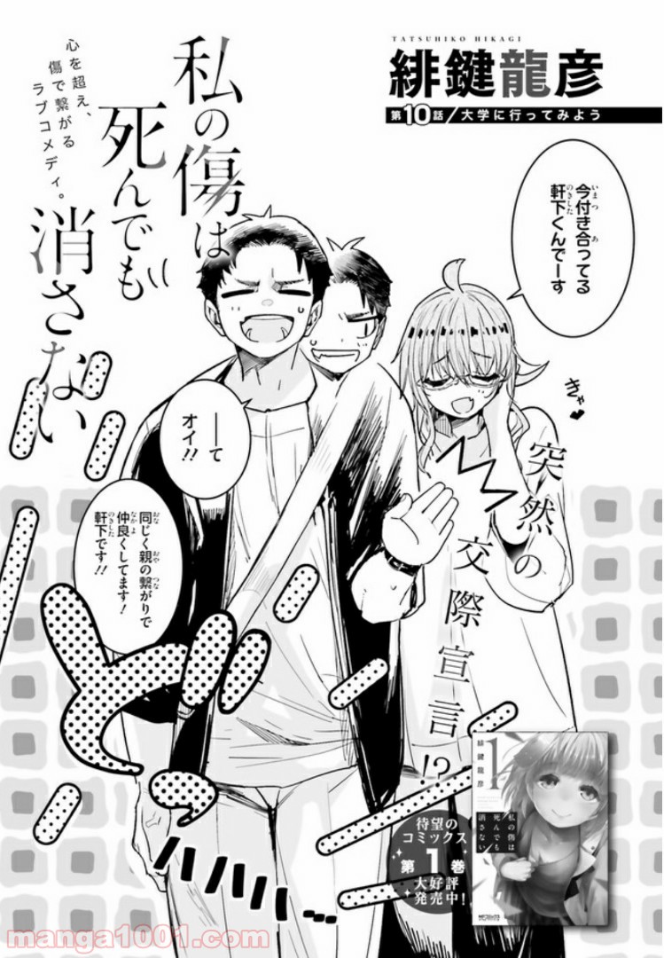 私の傷は死んでも消さない 第10.1話 - Trang 3