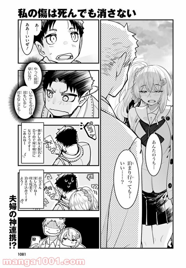 私の傷は死んでも消さない 第16.1話 - Trang 1