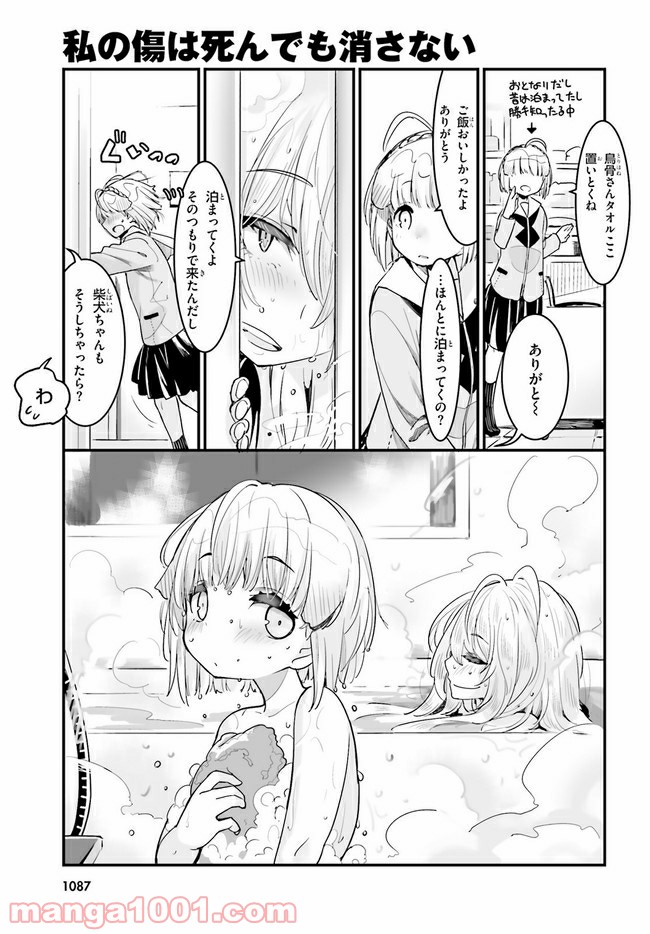 私の傷は死んでも消さない 第16.1話 - Trang 7