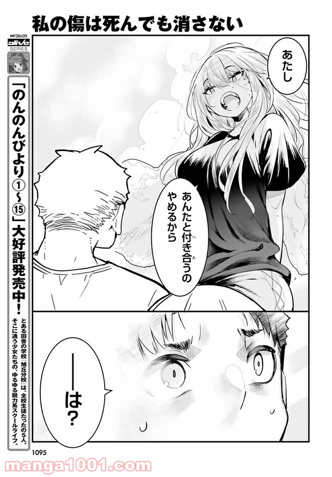 私の傷は死んでも消さない 第16.2話 - Trang 5