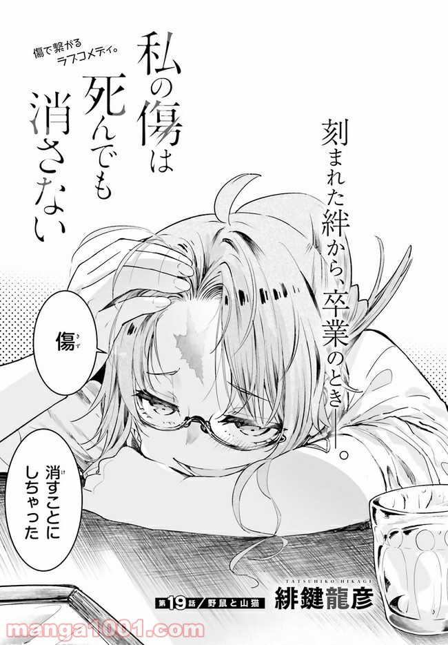 私の傷は死んでも消さない 第19.1話 - Trang 3